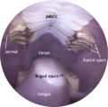 Thumbnail for version as of 19:17, 30 May 2016